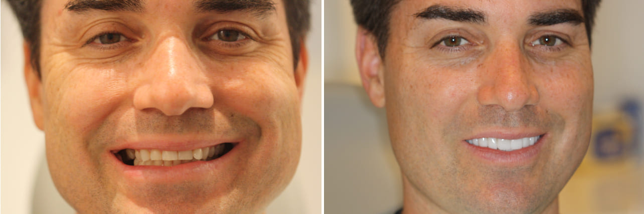 Dr. Bob Perkins DDS, Before and After Photo Gallery